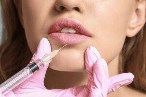 Dudak Dolgusu Sonrası Dudak Kuruluğu, Ne kadar sürer? Neden olur? Nasıl Önlenir?