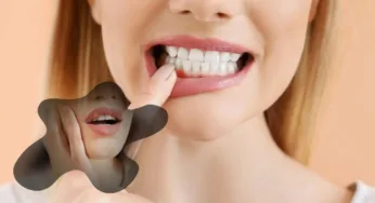 Diş Eti Ağrısı Neden Olur? Diş Eti Ağrısına Ne İyi Gelir?