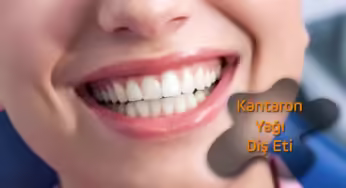Kantaron Yağı Diş Etine İyi Gelir mi?